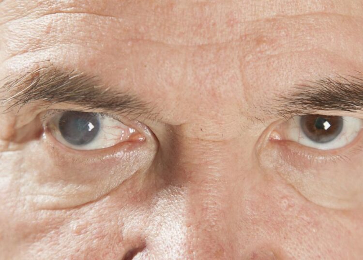 Kako spriječiti gubitak vida